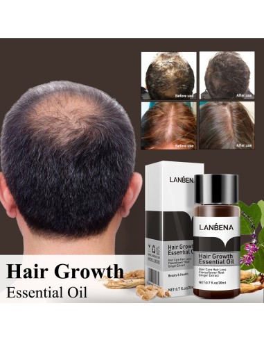 LANBENA-Sérum pour la croissance rapide des cheveux, traitement liquide du cuir chevelu